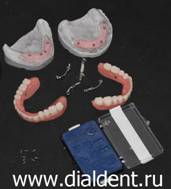 Полный набор всего что приходит из зуботехнической лаборатории "Диал-Дент" для сдачи пациенту зубопротезной конструкции