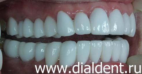 Белые зубы делают в "Диал-Дент"