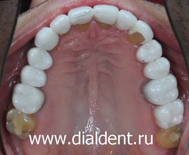 Лечение и протезирование зубов в Москве в Центре "Диал-Дент"