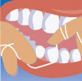 Как чистить зубы нитью (флоссом)?