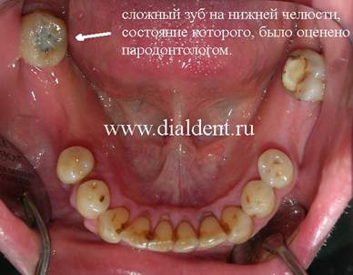 Описание: Протезирование зубов на Павелецкой