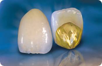 Самые лучшие и красивые зубные реставрации, протезы, коронки, виниры могут быть потеряны из-за плохо пролеченных каналов зубов. Диал-Дент