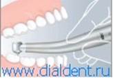 Костная пластика - часто применяемая процедура при имплантации зубов