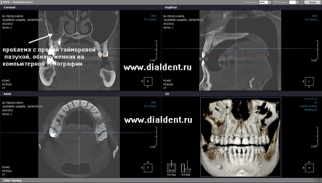 компьютерная томография челюстей в Диал-Дент